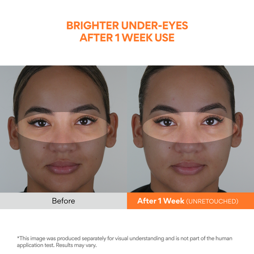 Vitamin C Niacinamide Brightening Eye Serum